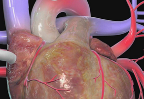 心臟搭橋手術(shù)風(fēng)險(xiǎn)大嗎