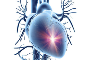 慢性心力衰竭的康復治療