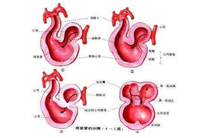 二尖瓣關閉不全的飲食注意事項