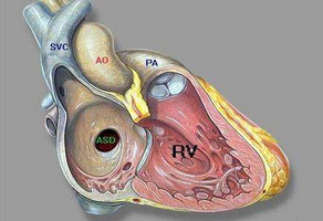 心肌梗塞怎么檢查出來(lái)？