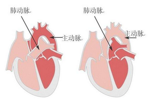 心律失常的檢查方法