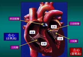 主動(dòng)脈瓣關(guān)閉不全如何飲食