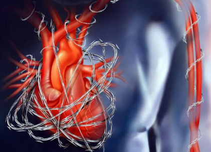 冠心病的護(hù)理