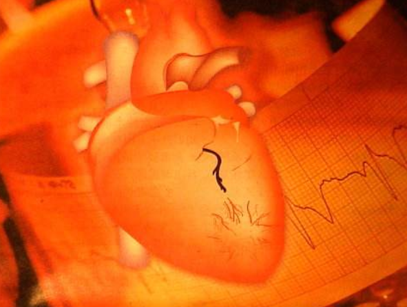 冠心病運(yùn)動(dòng)康復(fù)目的是什么