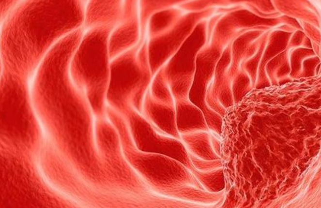 常見動脈硬化的檢查有哪些呢