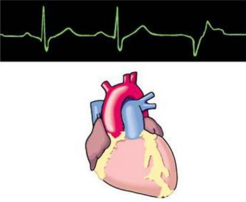 如何正確治療室性心律失常
