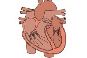 心臟病怎么樣有效地治療
