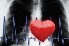 風濕性心臟病的治療注意事項