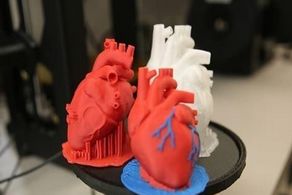 冠心病的高發(fā)期應(yīng)該在什么時期